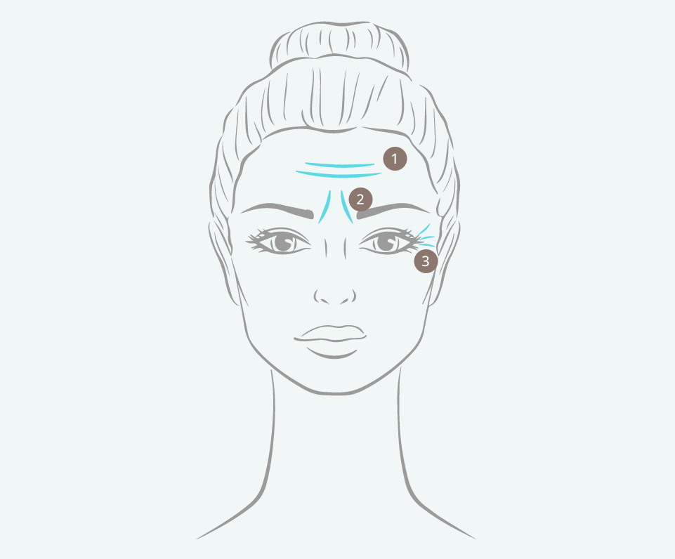 Grafik Falten Botox Behandlung